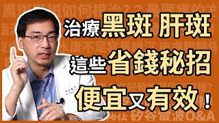 治療黑斑、肝斑，有哪些省錢又有效，高CP值的方法？醫美里長林政賢醫師大揭密！ [upl. by Aitnahc]