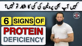 6 Signs Of Protein Deficiency  Protein Deficiency Symptoms  UrduHindi [upl. by Aitsirk399]