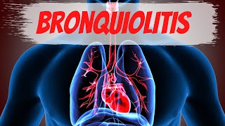 Bronquiolitis en el Adulto [upl. by Aliled948]