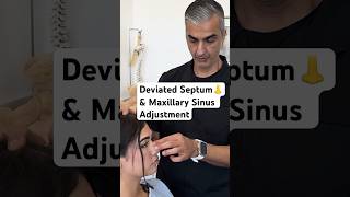 Deviated Septum amp Maxillary Sinus Adjustment chiropractic shorts [upl. by Ahsiuqel278]