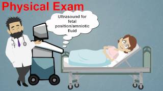 Topic 25 Premature Rupture of Membranes [upl. by Euqinommod]