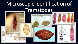 Microscopic identification of Trematodes [upl. by Capwell]