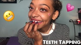 ASMR  Teeth Tapping 😬💗 [upl. by Papert]