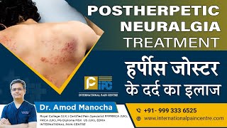 Postherpetic Neuralgia PHN Treatment  हर्पीस जोस्टर के दर्द का इलाज।by Dr Amod Manocha [upl. by Yttik235]