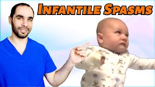 Infantile Spasms Causes And Treatment [upl. by Gwendolyn913]