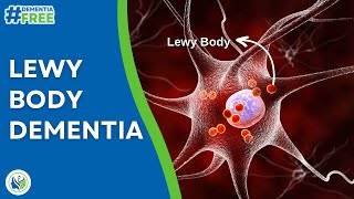 🔍 What is Lewy Body Dementia LBD  First signs of LBD  Voise Foundation [upl. by Xilef]