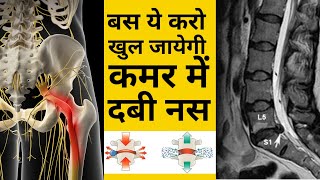 बस ये करो ठीक हो जाएगी कमर में दबी नस  L4L5 disc Bulge  SCIATICA  DABI NAS  leg pain  Hip pain [upl. by Ecitnerp]