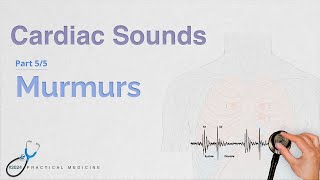 Cardiac Murmurs Pt 55 Cardiac Sounds Series [upl. by Apfel]