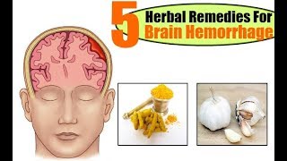 Top 5 Herbal Remedies For Brain Hemorrhage [upl. by Thomasa]