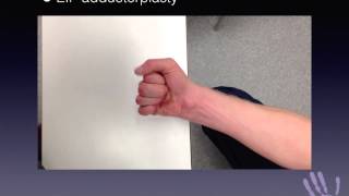 1 minute masterclass EIP adductorplasty for combined high ulnar and median nerve injury [upl. by Alleinad891]