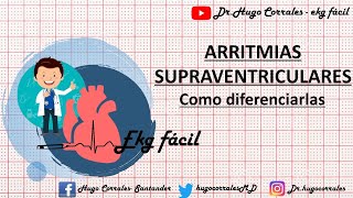 ARRITMIAS SUPRAVENTRICULARES  como diferenciarlas [upl. by Lugo]