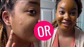 7 DAY TURMERIC amp HONEY FACE MASK  CHALLENGE [upl. by Ymaral]