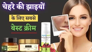 Best Cream for pigmentation  झाईयो के लिए सबसे अच्छी क्रीम Melasma Women problem [upl. by Sices740]