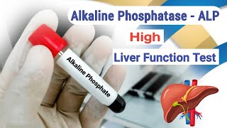 Alkaline Phosphatase Test  Liver Function Test  ALP  High Result [upl. by Dunston]