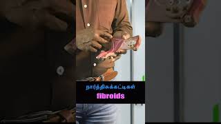 Bulky uterus கருப்பை ஏபிசி Uterus ABC [upl. by Ynnohj341]