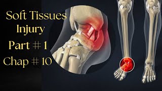 Soft tissues Injuries  Part1 Chapter10 Therapeutics [upl. by Enitsahc]