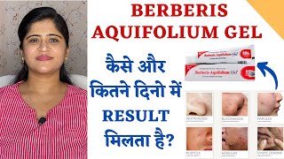 Berberis Aquifolium Gel for Acne and Scars ॥ कैसे और कितने दिनो में Result मिलता है [upl. by Alekin370]