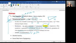 Acute l Fulminant l hepatic failure FHF [upl. by Leima]