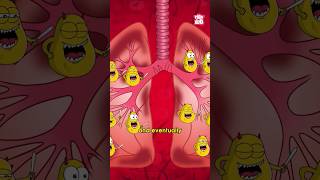 How TB Attacks the Body  World Tuberculosis Day 2024 diseases TB drbinocsshow peekabookidz [upl. by Revell]