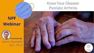 Know Your Disease Psoriatic Arthritis [upl. by Anayra]