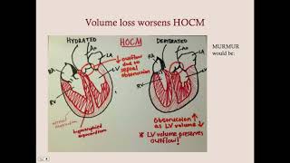 Cardiomyopathies  CRASH Medical Review Series [upl. by Laersi469]