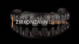 Prettau® 4 Anterior® zirconia on titanium  ZirkonzahnGalleries [upl. by Mclaurin]