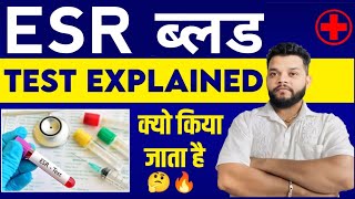 ESR Blood Test In Hindi  Gyanear [upl. by Ydwor]