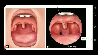 Apurba S Sastry Microbiology Infective Syndromes of Respiratory Tract part1 [upl. by Ahcila]