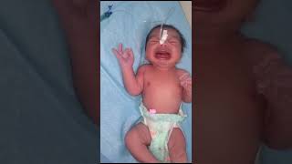 Big mouth normal body Face bruises of Chubbiest Newborn baby after birth due to Face presentation [upl. by Howzell60]