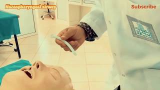 Nasopharyngeal Airway insertion [upl. by Jereme]