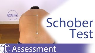 Schober Test for Lumbar Spine Flexion [upl. by Dnarud]