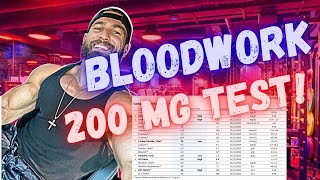 WHAT TO EXPECT ON 200 mg TESTOSTERONE per week  Bloodwork and How I feel after 4 months on 200mg [upl. by Annoid]