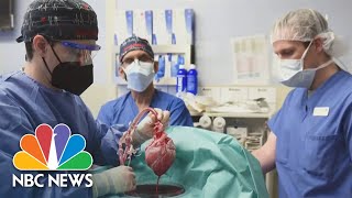 First Successful Transplant Of Pig Heart To Human Patient Performed In Maryland [upl. by Enayr257]