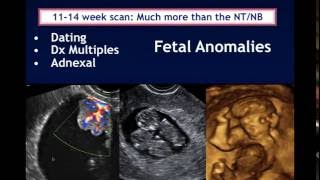 AIUM Webinar Systematic Evaluation of the 1114 Week Fetus Touching on ISUOG Guidelines [upl. by Lilly]