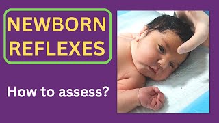 Newborn reflexes  8 vital reflexes of infants [upl. by Ula]