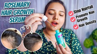 100 Effective Rosemary Hair Growth Serum✅Plix Rosemary Hair Growth Serum for hairfall amp hair growth [upl. by Hpesoj]