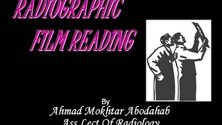 Radiographic Film Reading  For Medical students amp Non Radiologist [upl. by Ellwood]