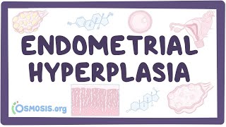 Endometrial hyperplasia  an Osmosis Preview [upl. by Brody]