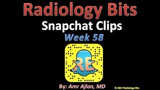 RADIOLOGY BITS SNAPCHAT WEEK 58 [upl. by Haig]