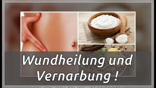 3 wunderbare Pflanzen zur besseren Wundheilung und Vernarbung [upl. by Deutsch929]