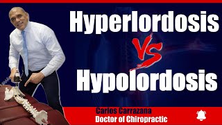 🟢 Hyperlordosis vs Hypolordosis Whats going on 🤔 [upl. by Akenor]