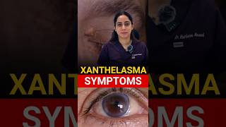 Most Common Symptoms Xanthelasma [upl. by Janik48]