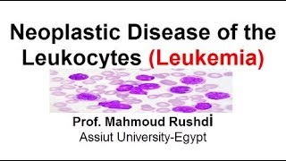 Neoplastic Disease of the Leukocytes  Leukemia Arabic Lecture [upl. by Atikehs]