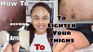 How To Lighten Dark Inner Thighs Fast and Effective Naturally [upl. by Jackelyn]