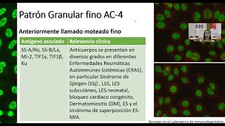 Inmunofluorescencia en el diagnóstico de enfermedades autoinmunes  Lcda Samantha Gutierrez [upl. by Aitetel219]