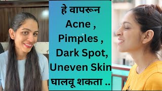 हे वापरून Acne Pimples Dark Spot घालवू शकता  पिंपल्स कायमचे कसे घालवावे  Daily Skincare Routine [upl. by Messere140]