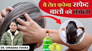 सफेद बालों को काला कैसे करें  Hair Growth Remedies  DrUpasana Vohra [upl. by Gurevich244]