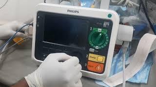 Philips Difibrilator DFM 100 Testing amp Analyser Procedure [upl. by Zined]