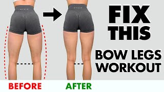 10 Min quotBow Legsquot Home Workout  FIX Bow Legs in 10 MinDay [upl. by Thaddeus]