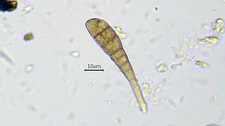 Growing of hyphae and septa formation in Alternaria sp  fast time lapse [upl. by Calesta20]